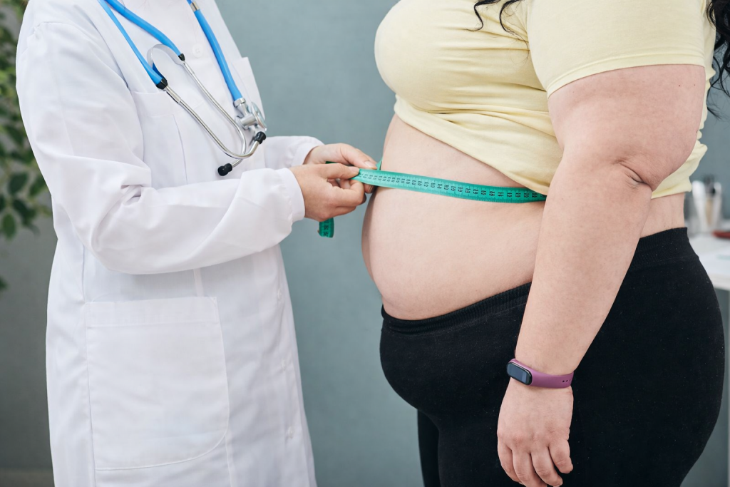 professionnel de santé mesurant le tour de taille d’une personne en situation de surpoids avec un mètre ruban