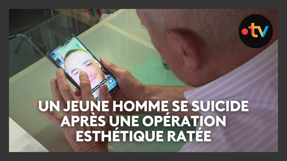 Greffe de barbe ratée