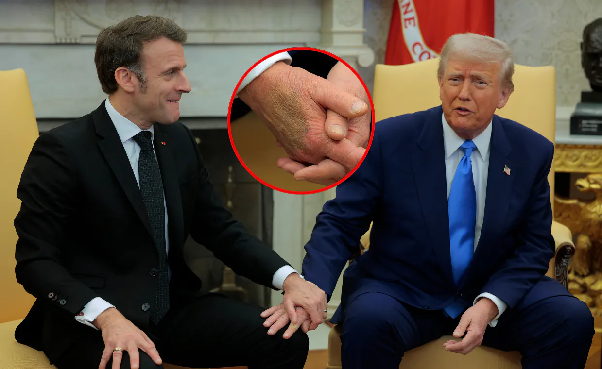Santé de Donald Trump : une photo troublante de sa main suscite rumeurs et inquiétudes. Ce que l’on sait vraiment aujourd’hui.