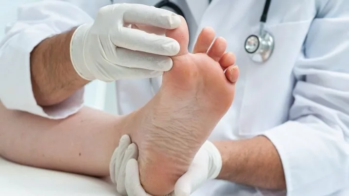 Mycose des ongles : comment la Terbinafine Biogaran guérit en profondeur