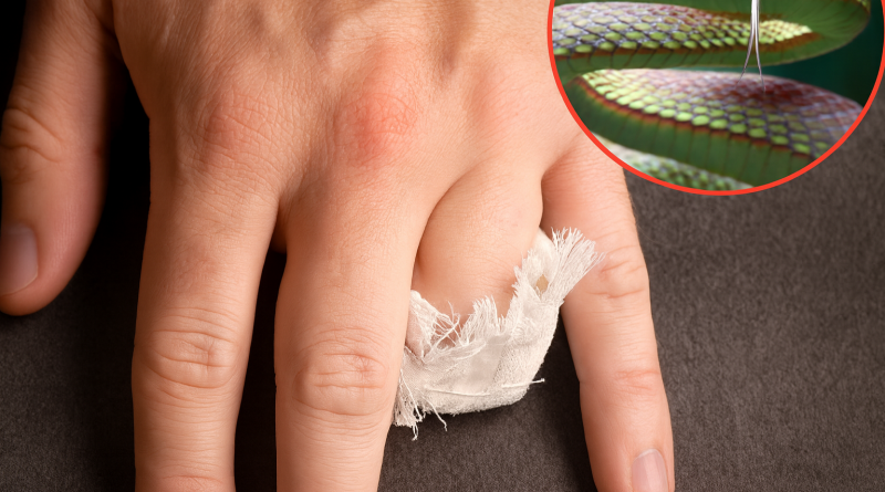 Main humaine en gros plan avec un doigt amputé partiellement bandé, posée sur une surface sombre, avec un petit médaillon montrant un serpent aux écailles colorées.